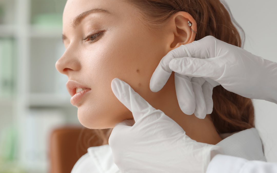 Melanoma Treatment Orland Park: Top Methods