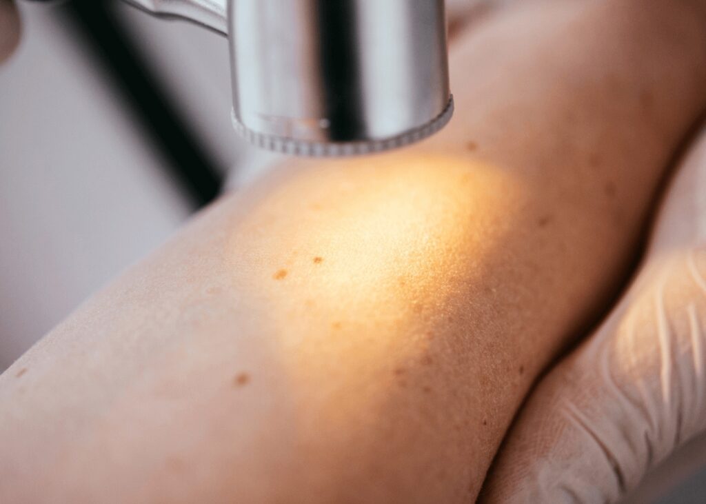 Dermatologist using dermatoscope for skin exam in New Lenox clinic setting.